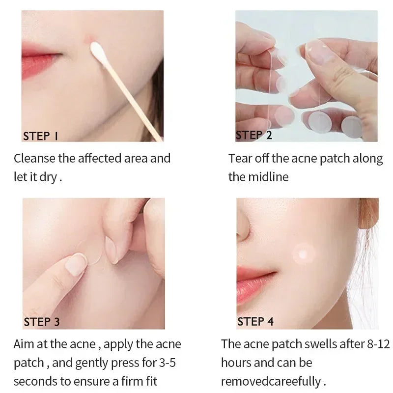 Clear Acne Quickly with Invisible Hydrocolloid Healing Patches