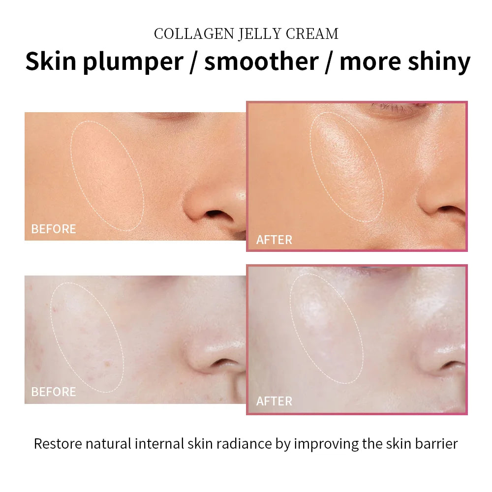 Lakerain Collagen Jelly Cream | Brighten, Hydrate & Lift Your Skin