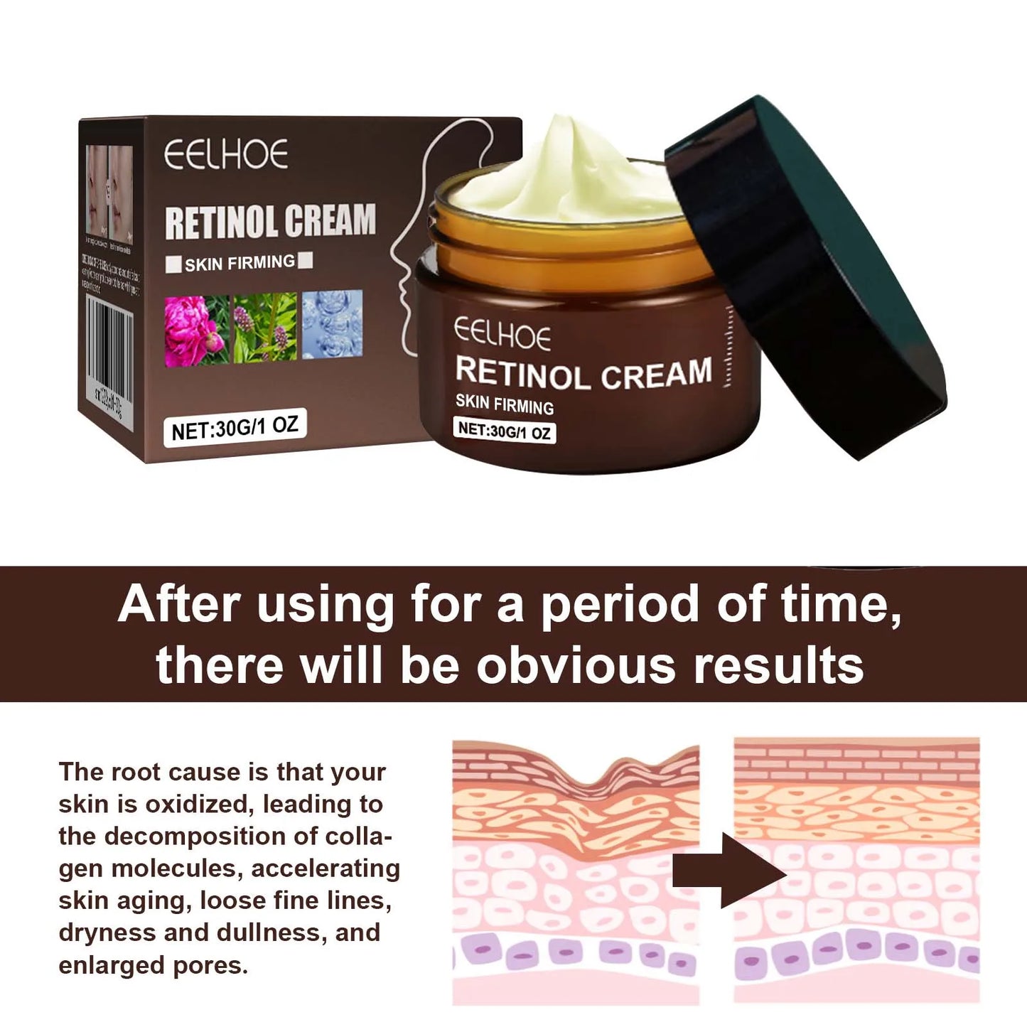 Eelhoe Retinol Face Cream – Anti-Aging, Brightening & Hydrating