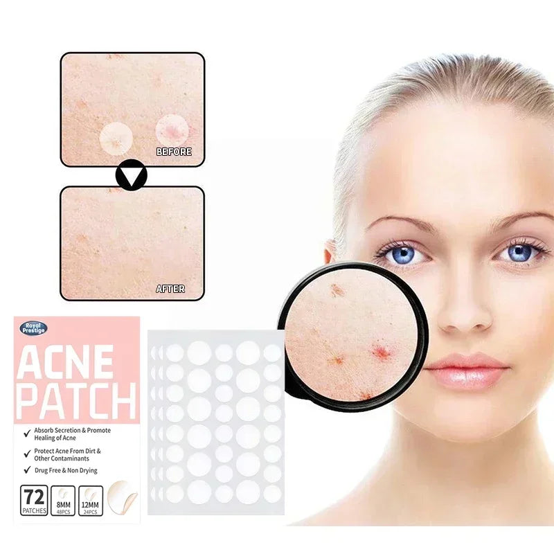 Clear Acne Quickly with Invisible Hydrocolloid Healing Patches